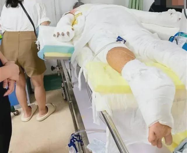 突发爆燃重度烧伤！这个行为很要命！(图1)