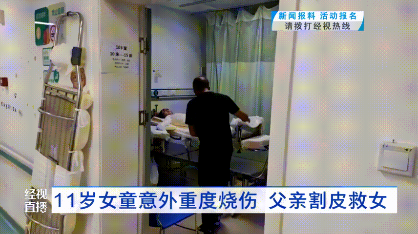 突发爆燃重度烧伤！这个行为很要命！(图2)