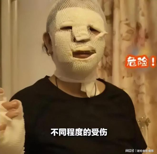 北京男子烧烤事故致7人受伤真相引发热议。(图8)