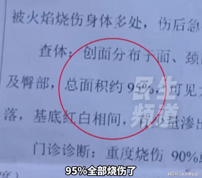 女子烹饪时自制燃气罐爆炸面部重伤母亲泪洒：只她一个女儿。(图4)